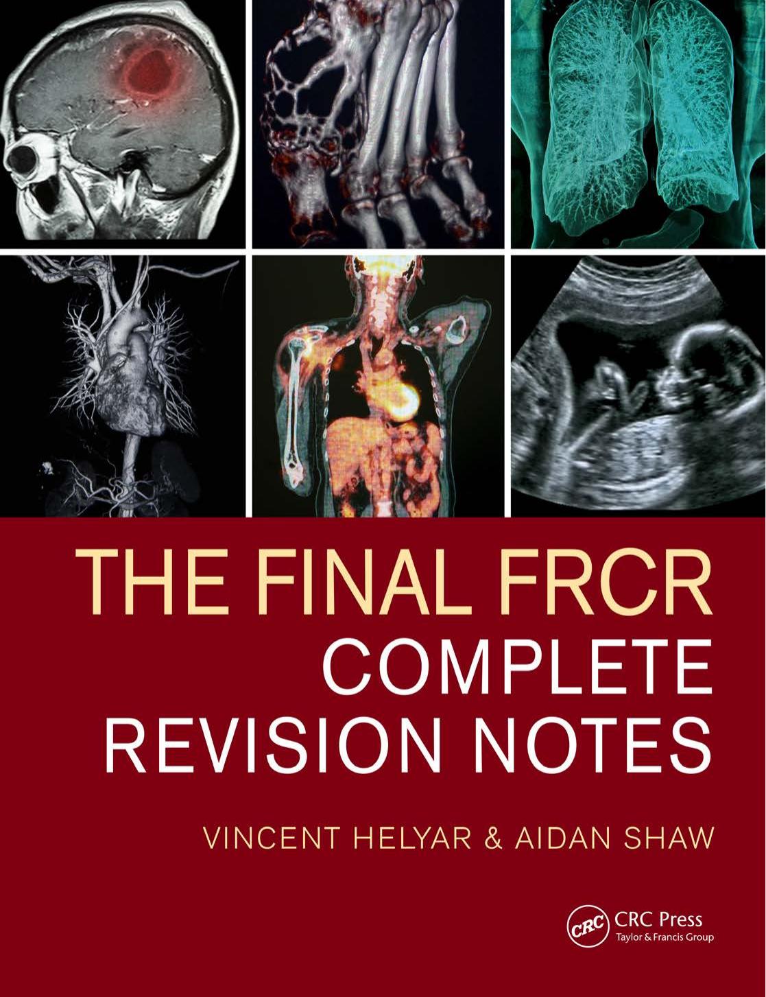 The Final FRCR: Complete Revision Notes by Unknow