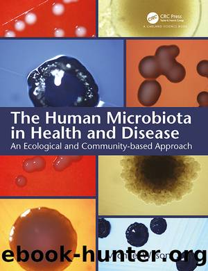 The Human Microbiota in Health and Disease by Mike Wilson;