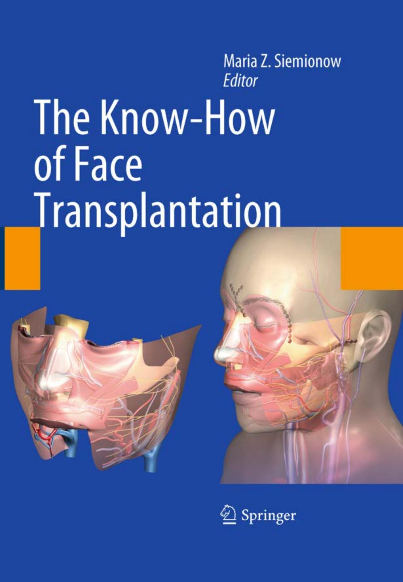 The Know-How of Face Transplantation by Maria Z. Siemionow