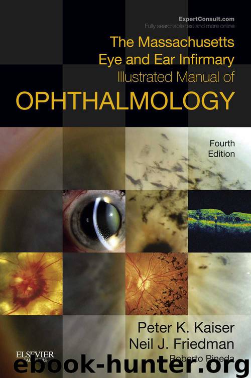 The Massachusetts Eye and Ear Infirmary Illustrated Manual of Ophthalmology by Peter K. Kaiser & Neil J. Friedman & Pineda II Roberto II