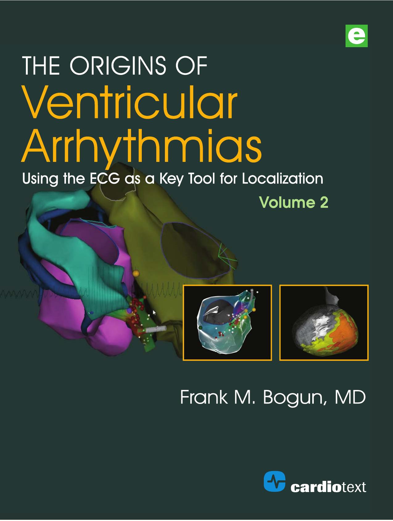 The Origins of Ventricular Arrhythmias: Using the ECG as a Key Tool for Localization, Volume 2 by Frank M. Bogun