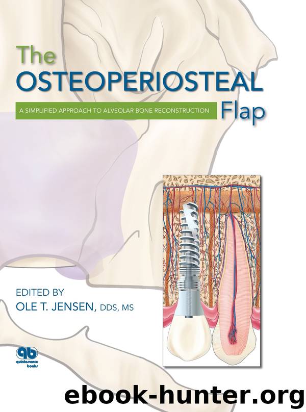 The Osteoperiosteal Flap: A Simplified Approach to Alveolar Bone Reconstruction by Quintessence Pub; 1 edition (December 15 2009)