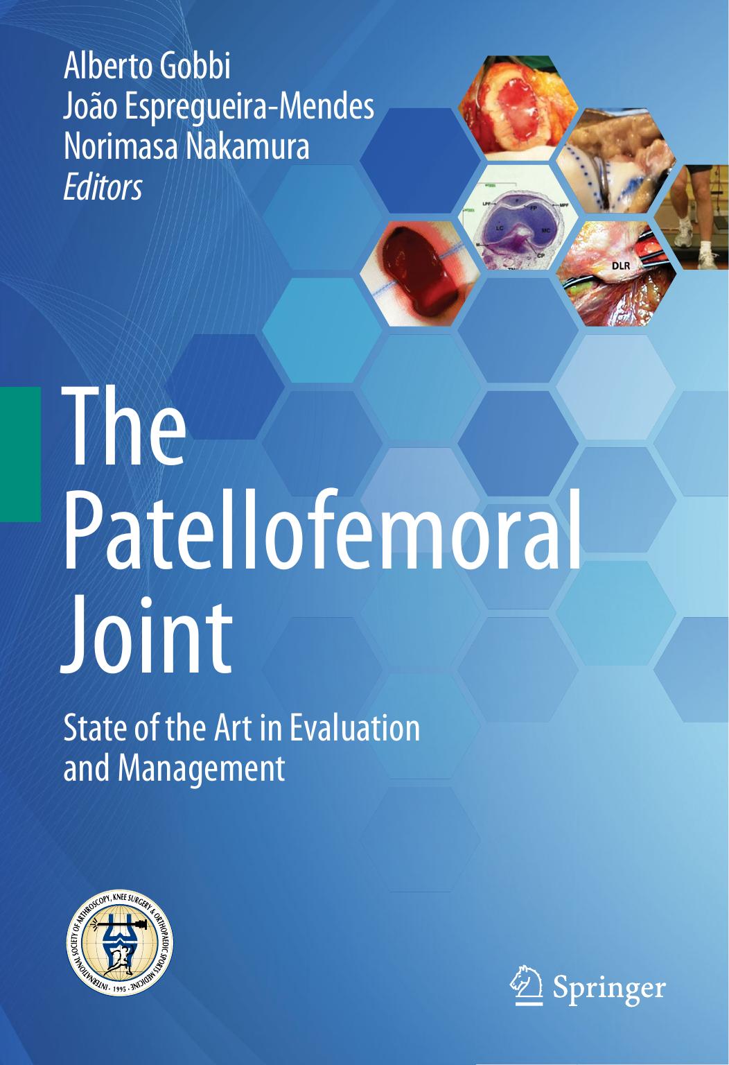 The Patellofemoral Joint: State of the Art in Evaluation and Management (Repost) by Unknow