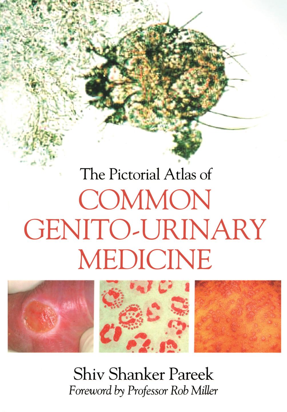The Pictorial Atlas of Common Genito-Urinary Medicine by Unknow