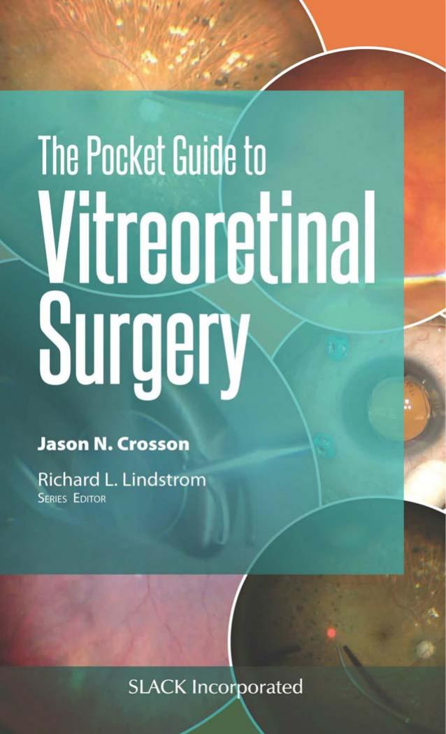 The Pocket Guide to Vitreoretinal Surgery by Jason Crosson MD