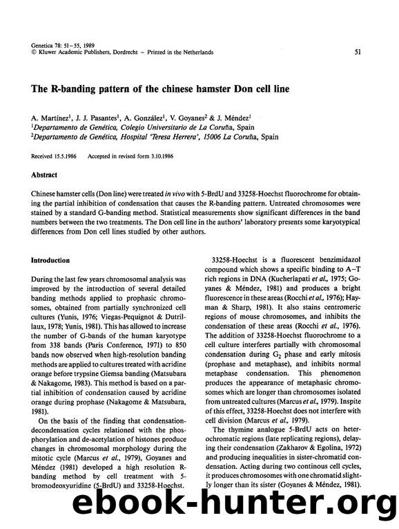 The R-banding pattern of the chinese hamster Don cell line by Unknown