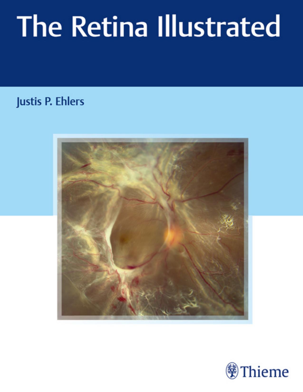 The Retina Illustrated by Justis P. Ehlers