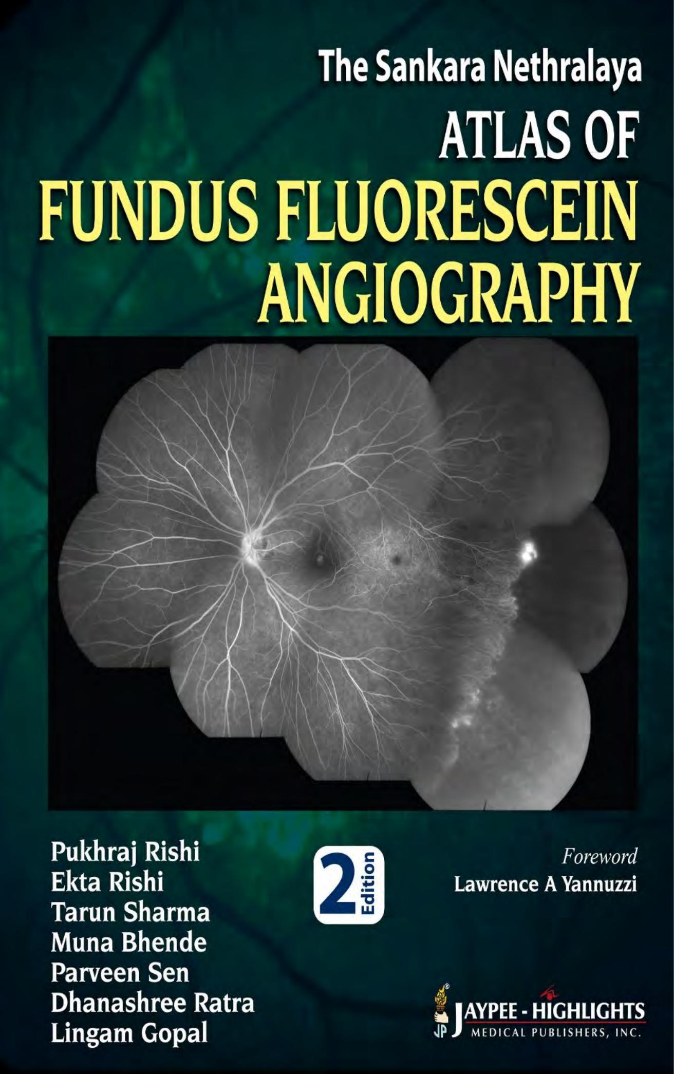The Sankara Nethralaya Atlas of Fundus Fluorescein Angiography by Unknow