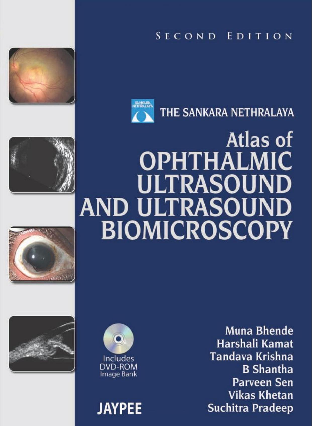 The Sankara Nethralaya Atlas of Ophthalmic Ultrasound and Ultrasound Biomicroscopy by unknow