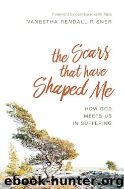 The Scars That Have Shaped Me: How God Meets Us in Suffering by Vaneetha Risner