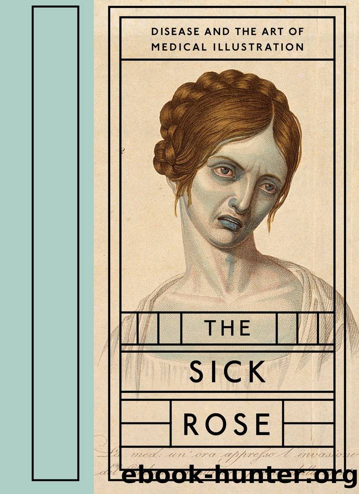 The Sick Rose by Richard Barnett