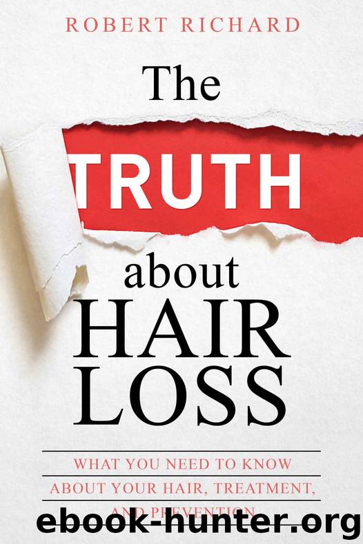 The TRUTH about Hair Loss: What You Need to Know about Your Hair, Treatment, and Prevention (Hair Loss cure, Alopecia, MPB, Male pattern baldness, Hair Loss Treatment) by Richard Robert
