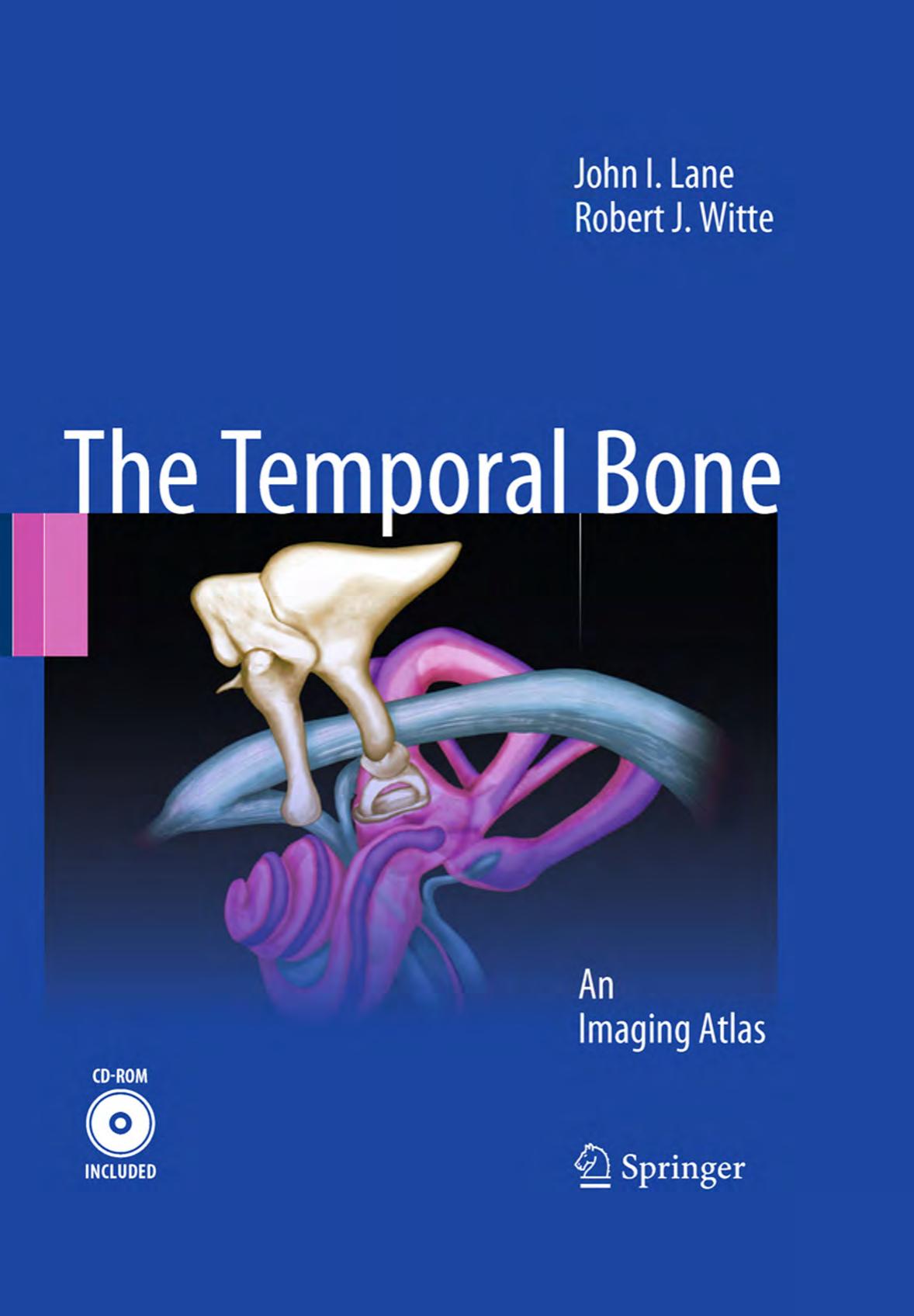 The Temporal Bone: An Imaging Atlas by John I. Lane MD Robert J. Witte MD (auth.)
