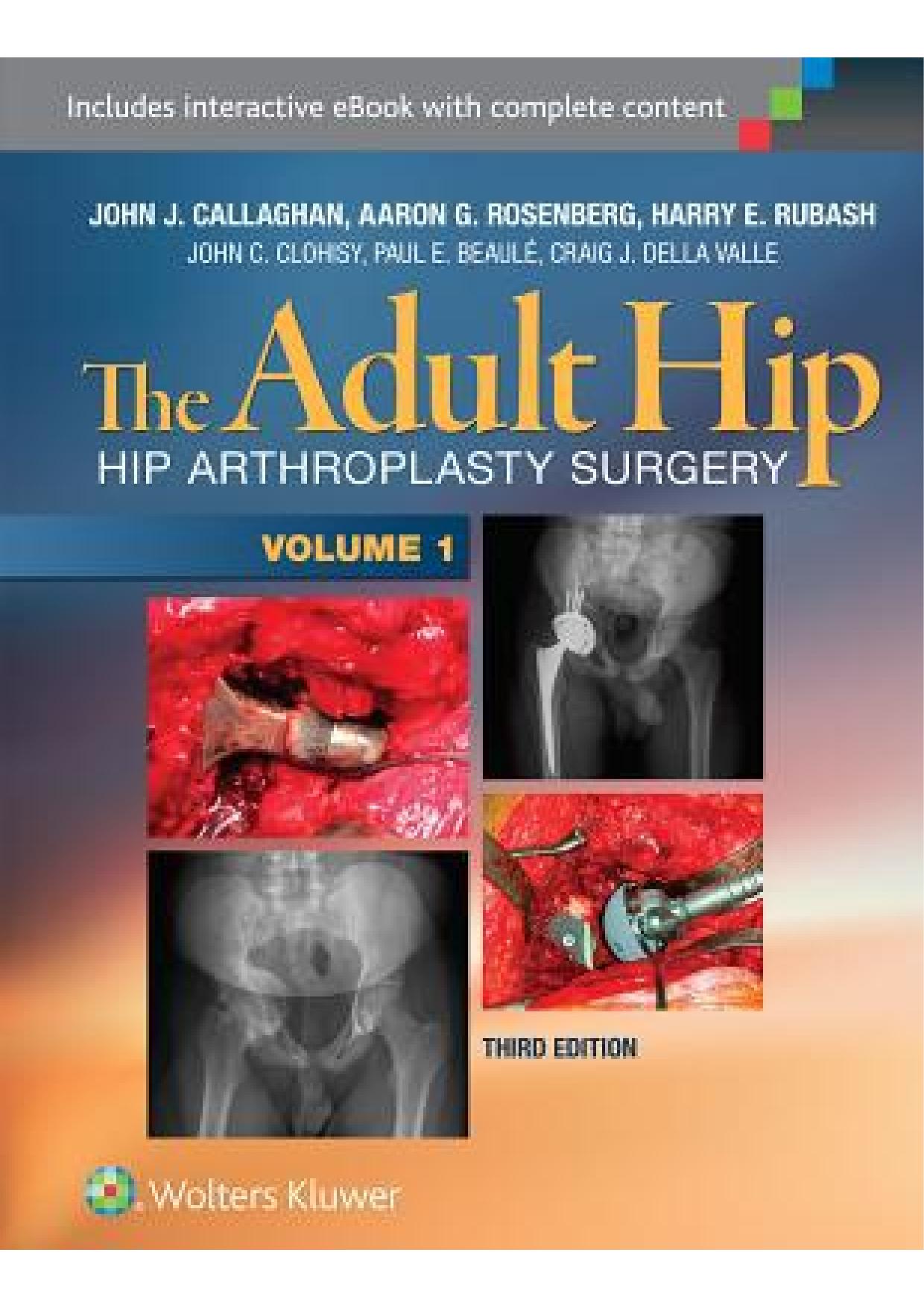 The adult hip: Hip arthroplasty surgery by John J. Callaghan Aaron G. Rosenberg Harry E. Rubash et al