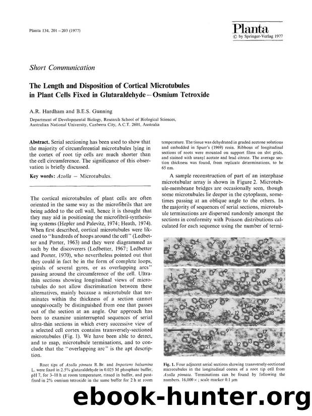 The length and disposition of cortical microtubules in plant cells fixed in glutaraldehyde—Osmium tetroxide by Unknown