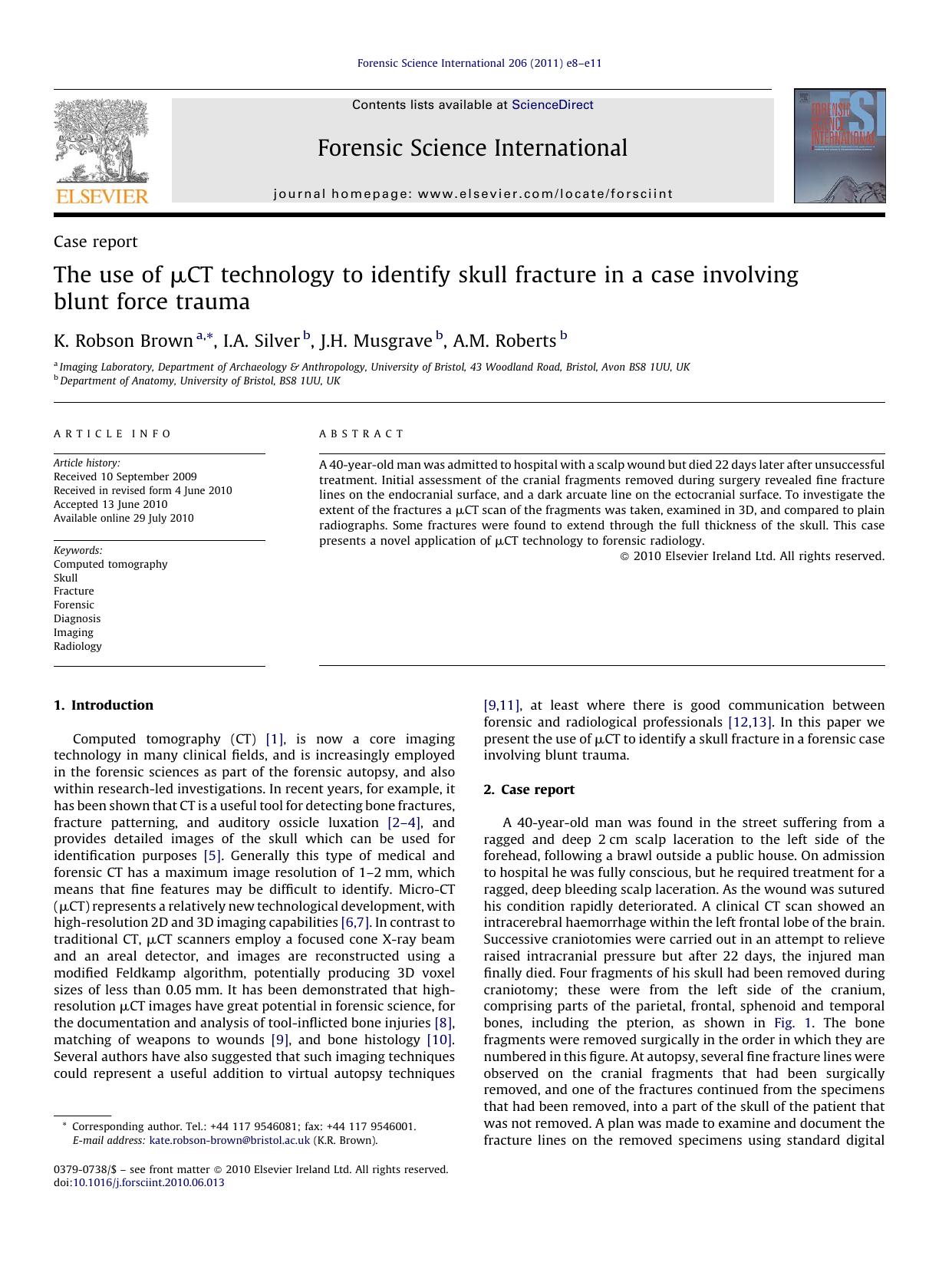 The use of ÃÂ¼CT technology to identify skull fracture in a case involving blunt force trauma by K. Robson Brown