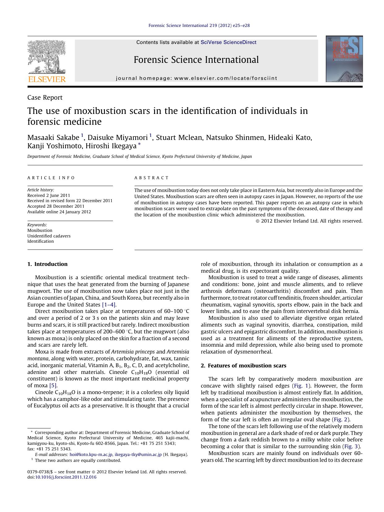 The use of moxibustion scars in the identification of individuals in forensic medicine by Masaaki Sakabe