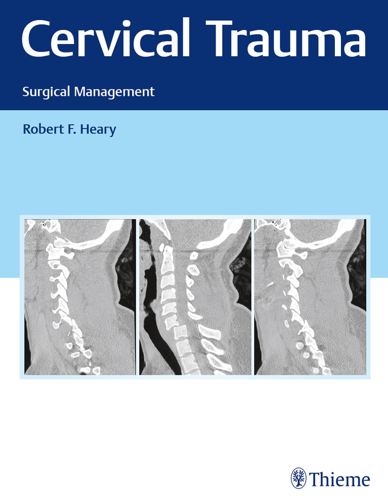 Thieme: Cervical Trauma by Heary Robert F