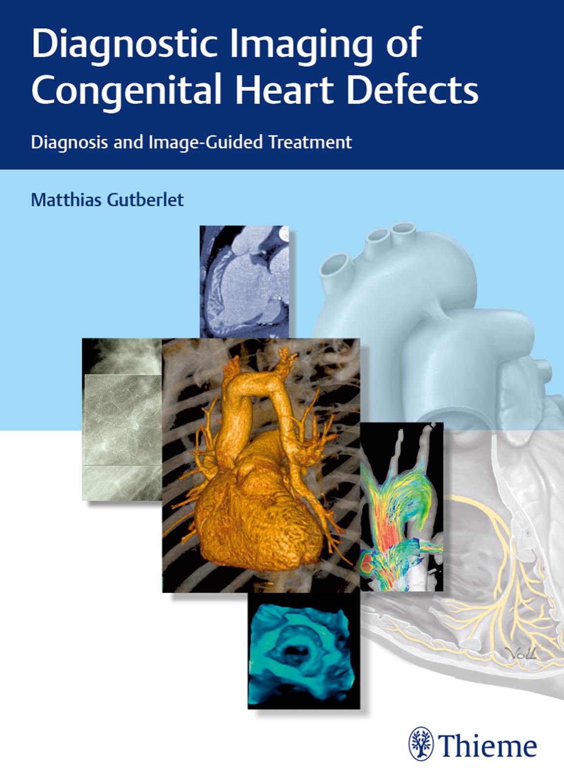 Thieme: Diagnostic Imaging of Congenital Heart Defects by Gutberlet Matthias