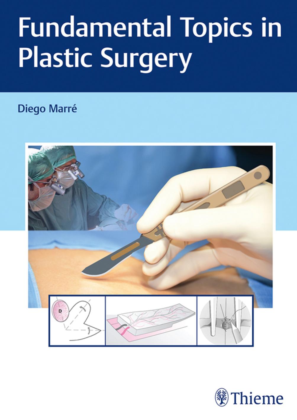 Thieme: Fundamental Topics in Plastic Surgery by Marré Diego