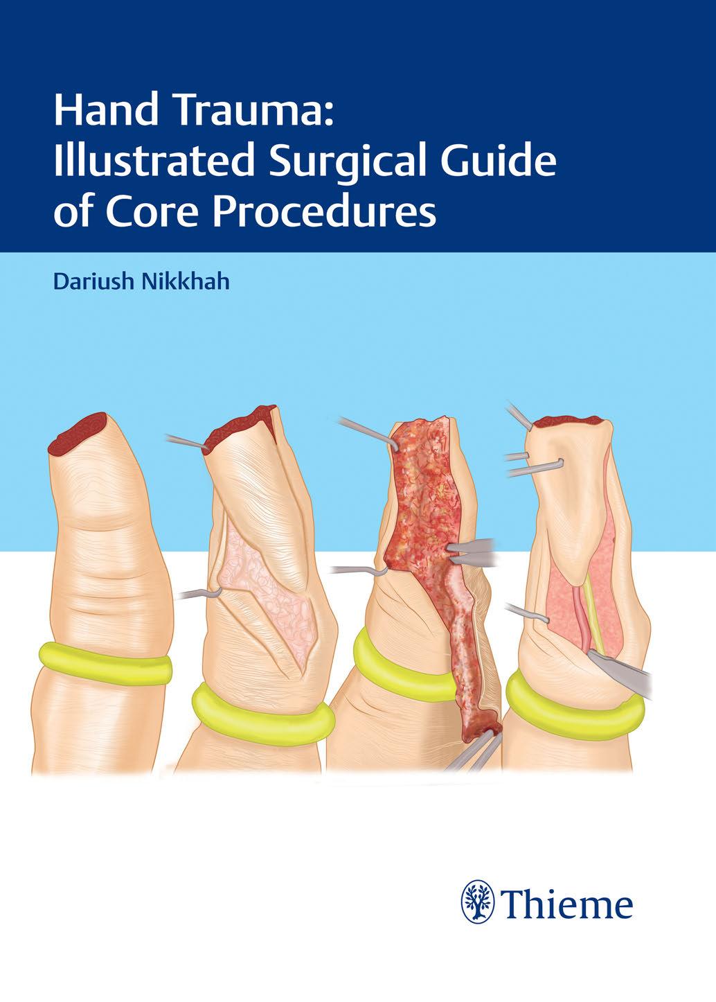Thieme: Hand Trauma: Illustrated Surgical Guide of Core Procedures by Nikkhah Dariush;