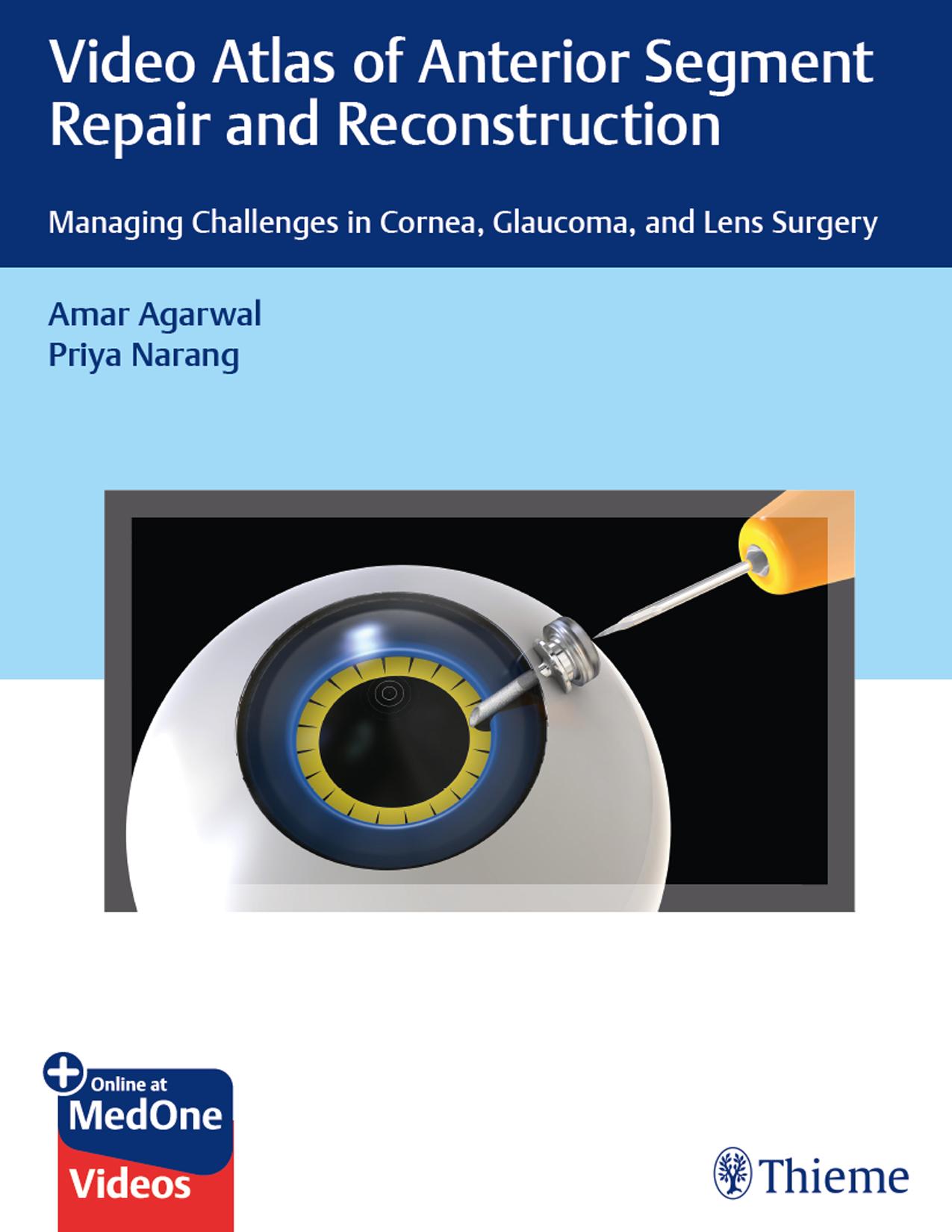 Thieme: Video Atlas of Anterior Segment Repair and Reconstruction: Managing Challenges in Cornea, Glaucoma, and Lens Surgery by Agarwal Amar; Priya Narang & Priya Narang