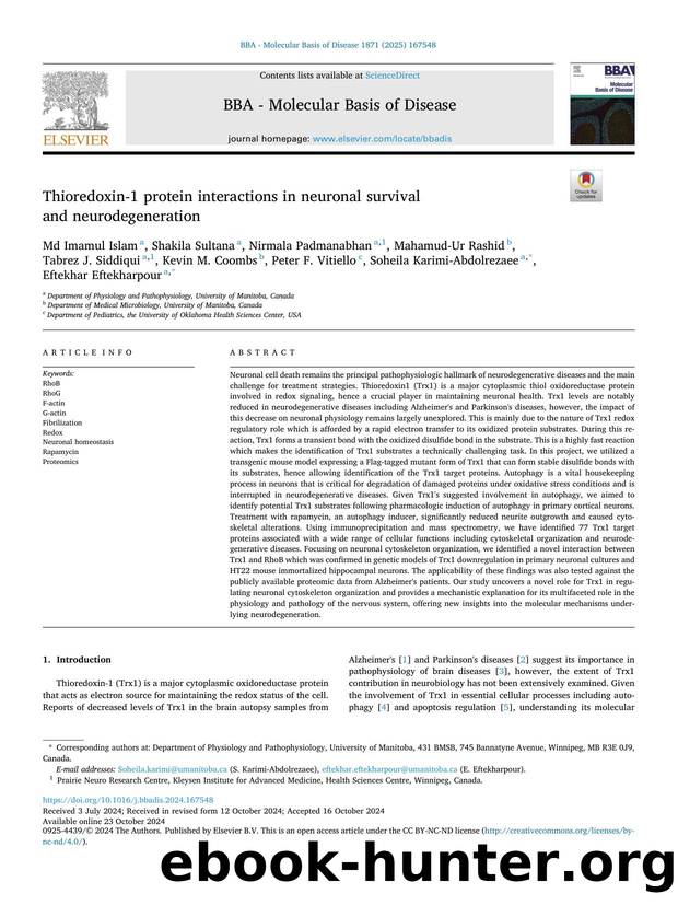 Thioredoxin-1 protein interactions in neuronal survival and neurodegeneration by unknow