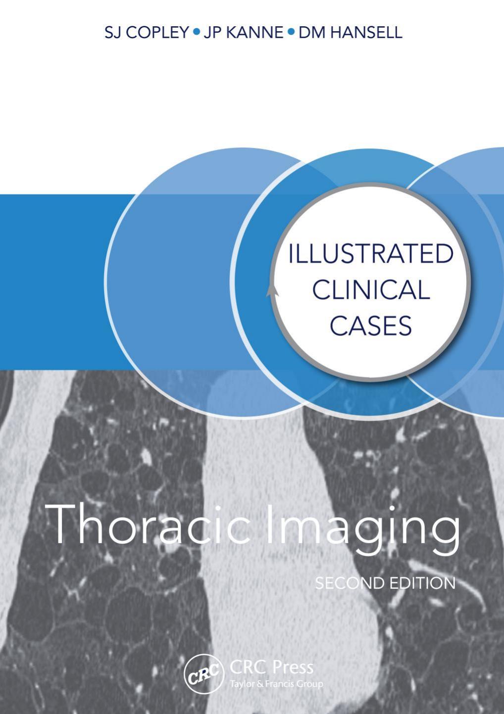 Thoracic Imaging: Illustrated Clinical Cases, Second Edition by Sue Copley