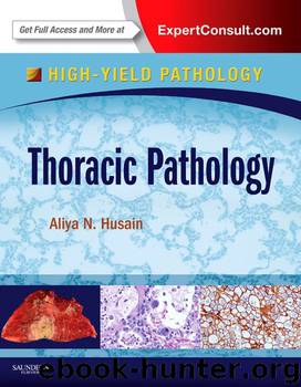 Thoracic Pathology: A Volume in the High Yield Pathology Series (Expert Consult - Online and Print) by Husain Aliya