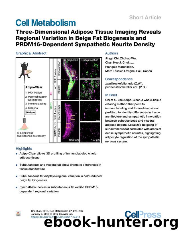 Three-Dimensional Adipose Tissue Imaging Reveals Regional Variation in Beige Fat Biogenesis and PRDM16-Dependent Sympathetic Neurite Density by unknow