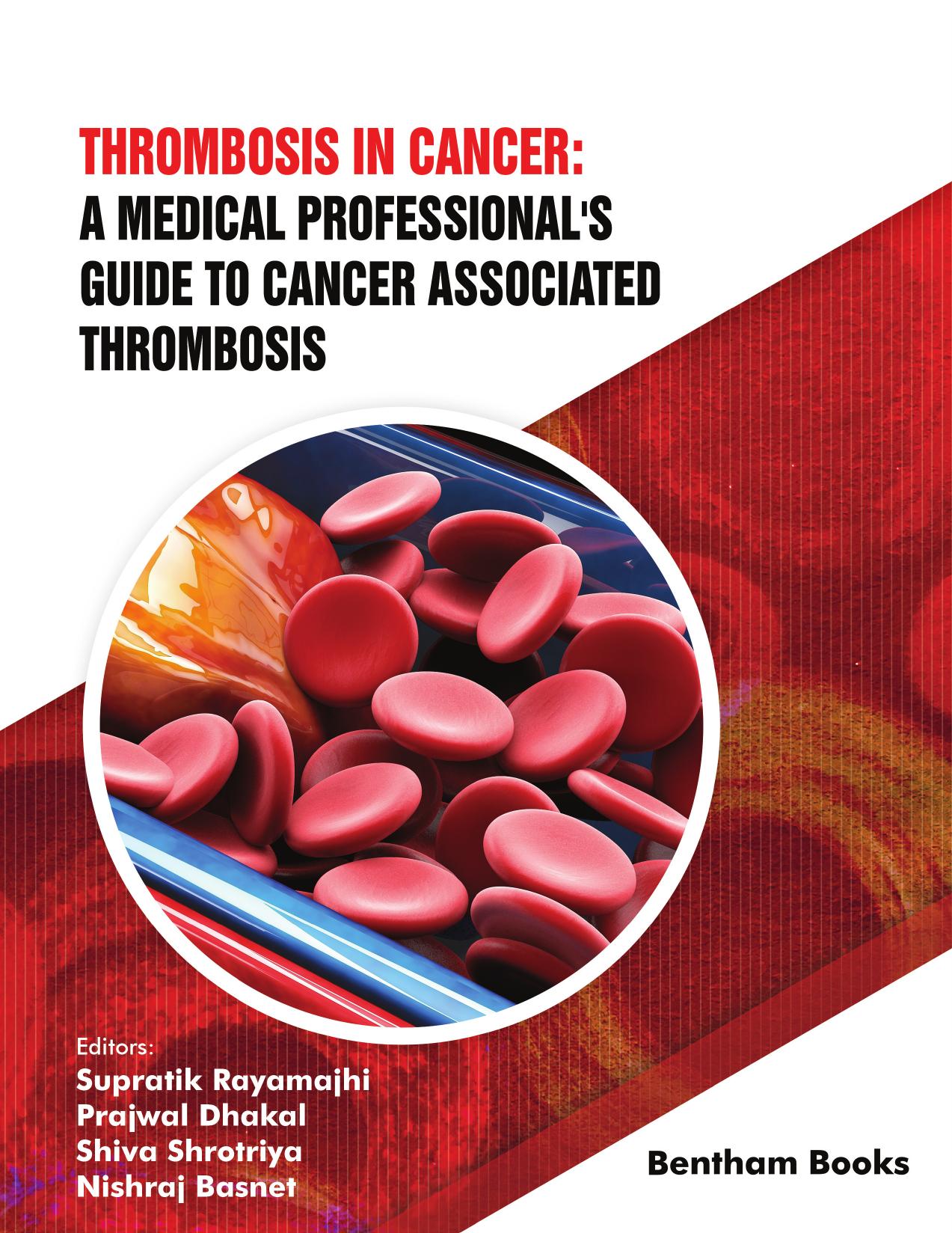 Thrombosis in Cancer: A Medical Professional`s Guide to Cancer Associated Thrombosis by Supratik Rayamajhi Prajwal Dhakal Shiva Shrotriya Nishraj Basnet