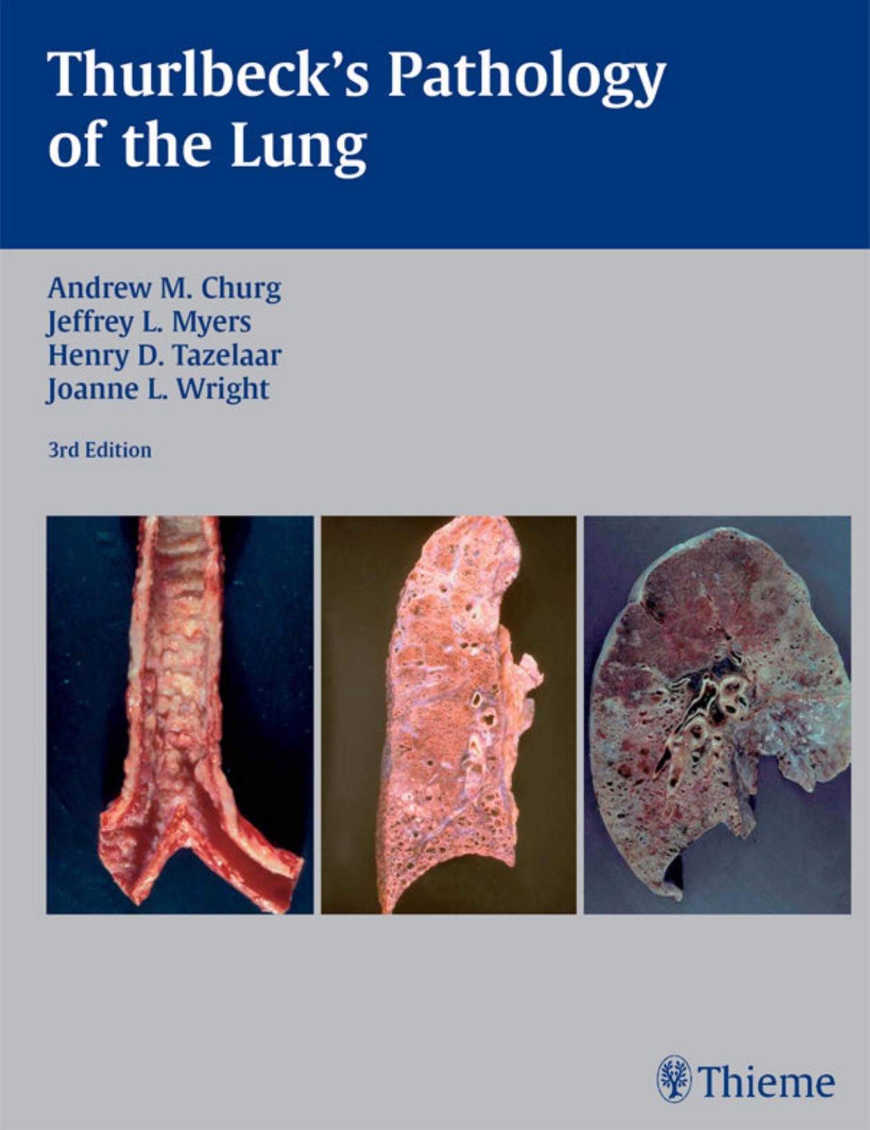 Thurlbeckâs pathology of the lung by Andrew M. Churg Jeffrey L. Myers Henry D. Tazelaar Joanne L. Wright William M. Thurlbeck