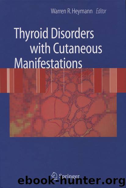 Thyroid Disorders with Cutaneous Manifestations by Warren R. Heymann
