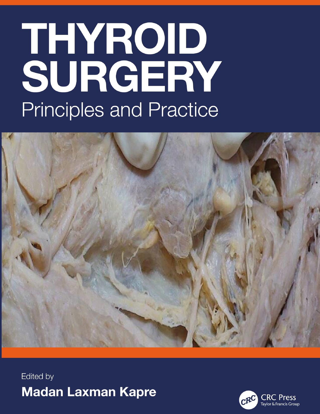 Thyroid Surgery; Principles and Practice by Madan Laxman Kapre