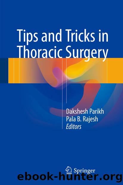 Tips and Tricks in Thoracic Surgery by Dakshesh Parikh & Pala B. Rajesh