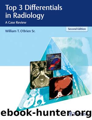 Top 3 Differentials in Radiology by William T. O'Brien Sr