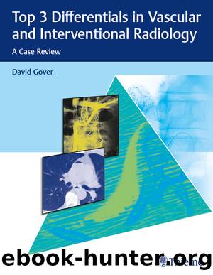 Top 3 Differentials in Vascular and Interventional Radiology by Gover David; O'Brien William T.;