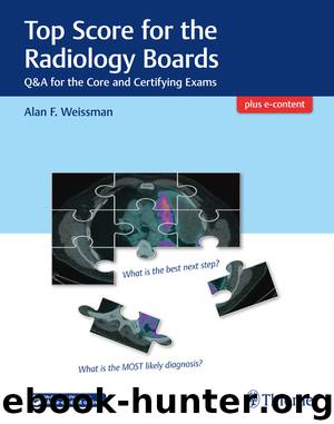 Top Score for the Radiology Boards by Weissman Alan;