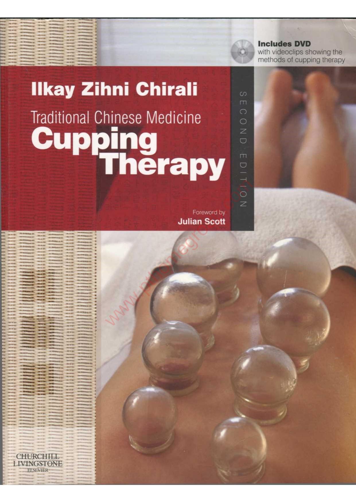 Traditional Chinese Medicine Cupping Therapy by Ilkay Z. Chirali MBAcC RCHM
