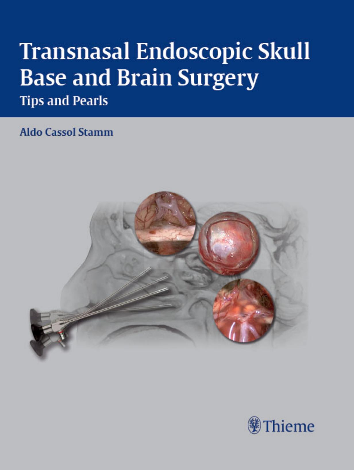 Transasal endoscopic skull base and brain surgery: tips and pearls by Aldo Cassol Stamm