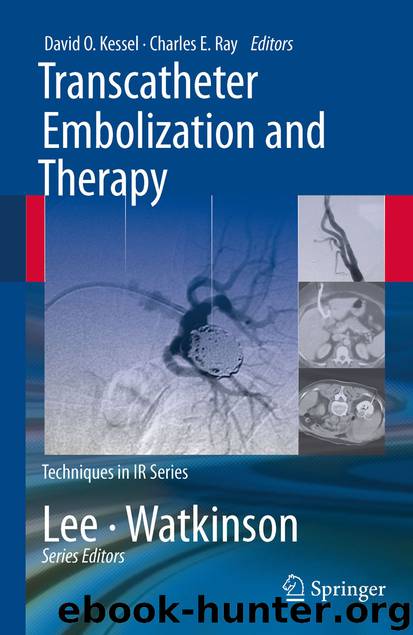 Transcatheter Embolization and Therapy by David Kessel & Charles Ray