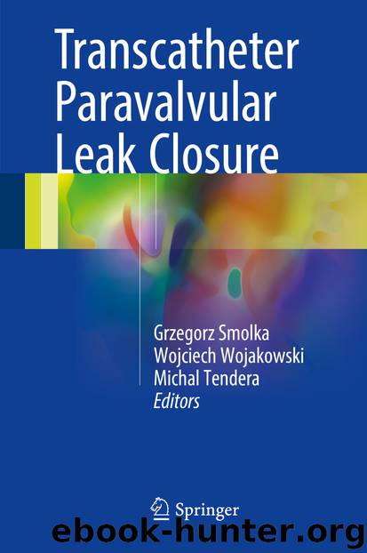 Transcatheter Paravalvular Leak Closure by Grzegorz Smolka Wojciech Wojakowski & Michal Tendera