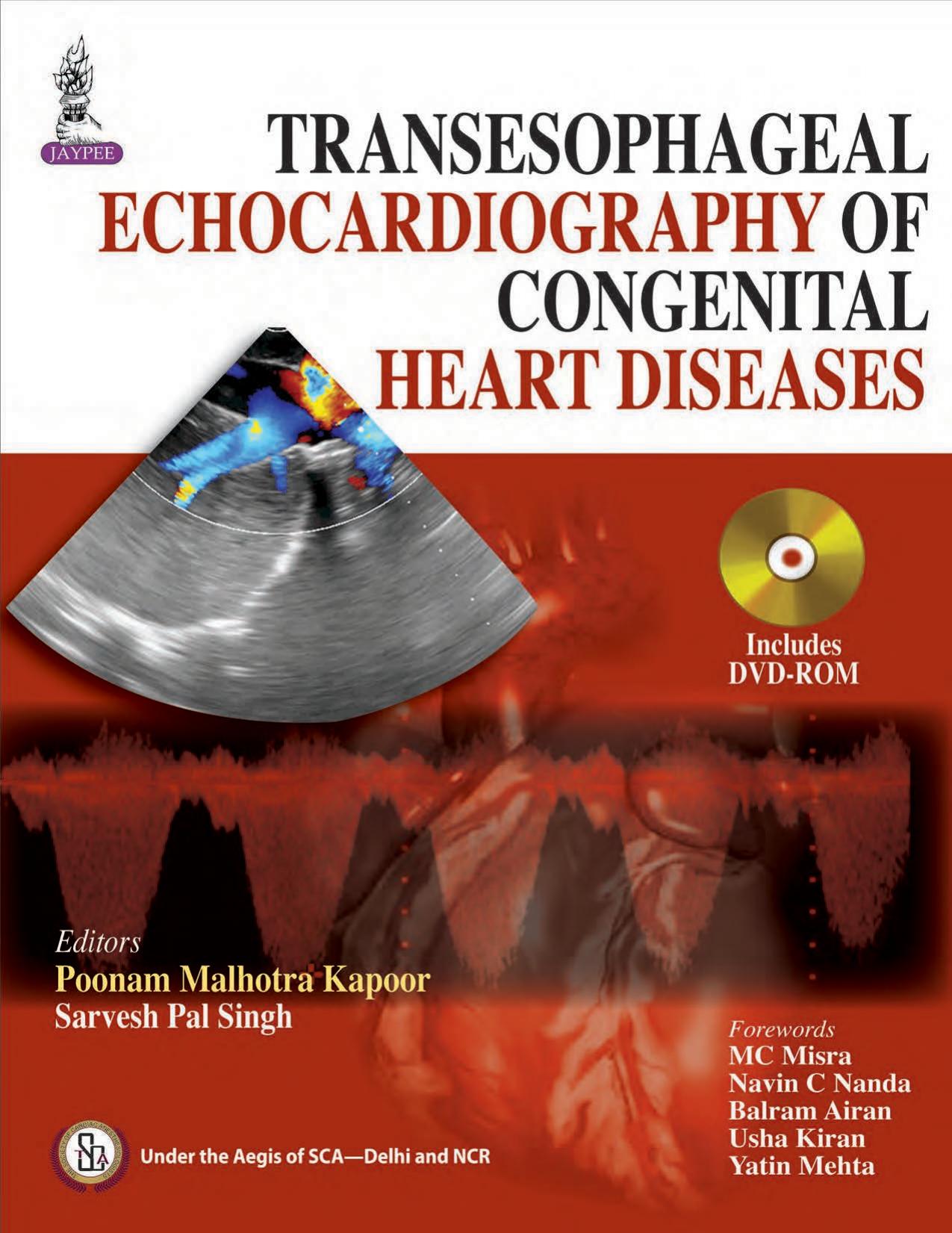 Transesophageal Echocardiography of Congenital Heart Diseases by Sarvesh Pal Singh; Poonam Malhotra Kapoor