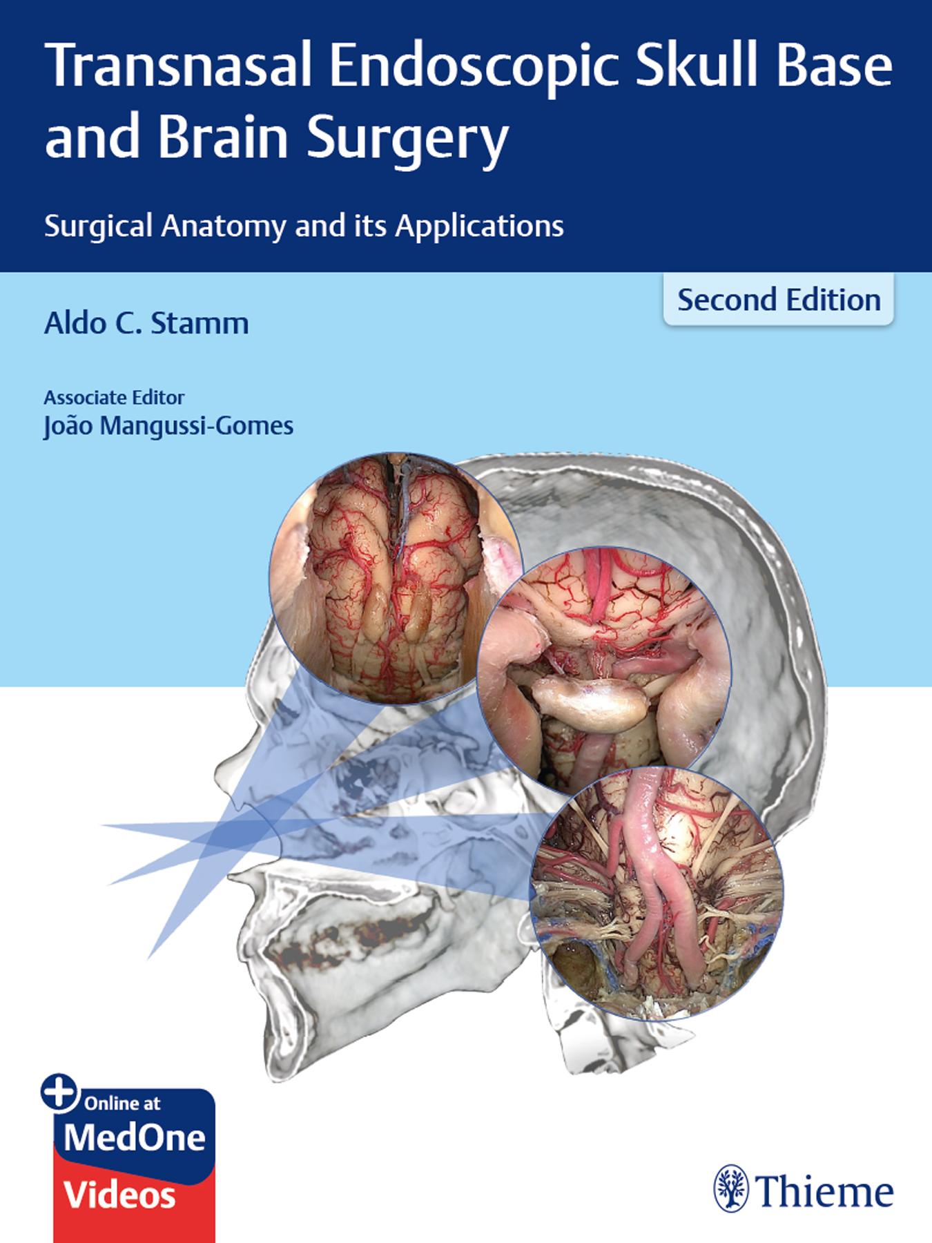 Transnasal endoscopic skull base and brain surgery : surgical anatomy and its applications by Stamm Aldo Cassol