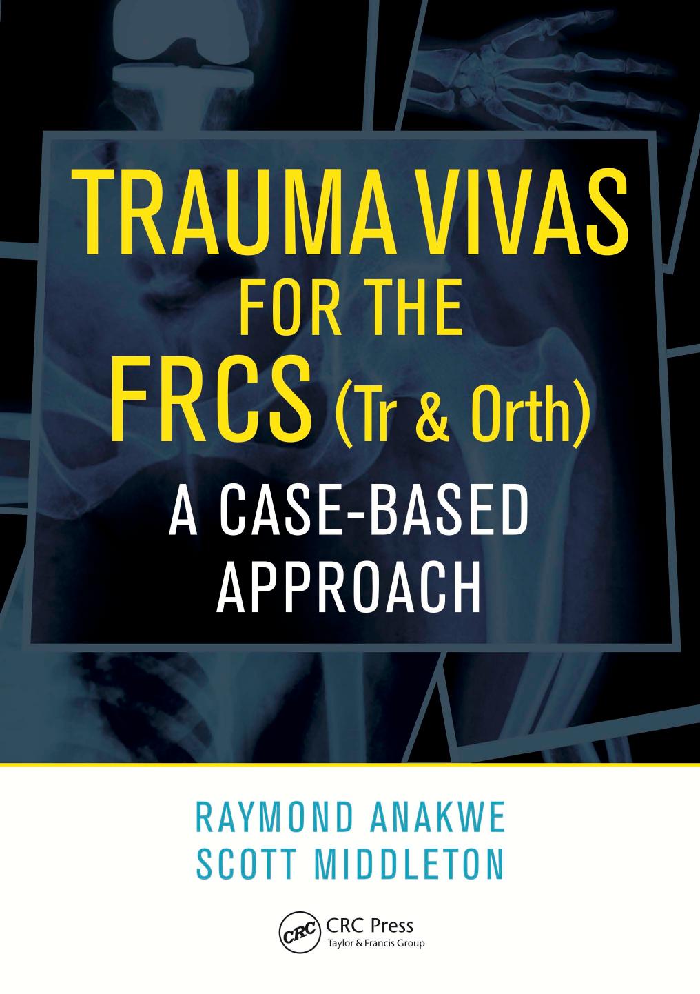 Trauma Vivas for the FRCS : a Case-Based Approach by Anakwe Raymond; Middleton Scott