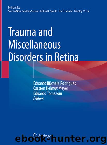 Trauma and Miscellaneous Disorders in Retina by Unknown