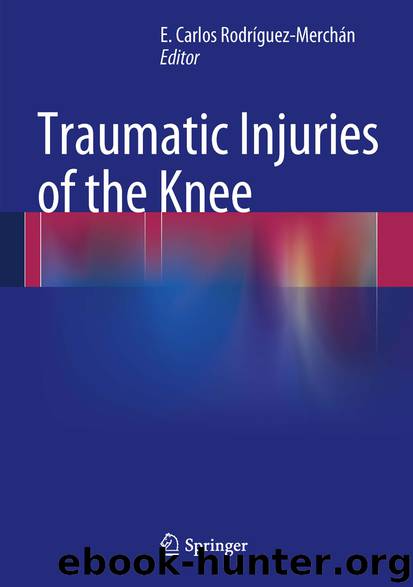 Traumatic Injuries of the Knee by E. Carlos Rodríguez-Merchán