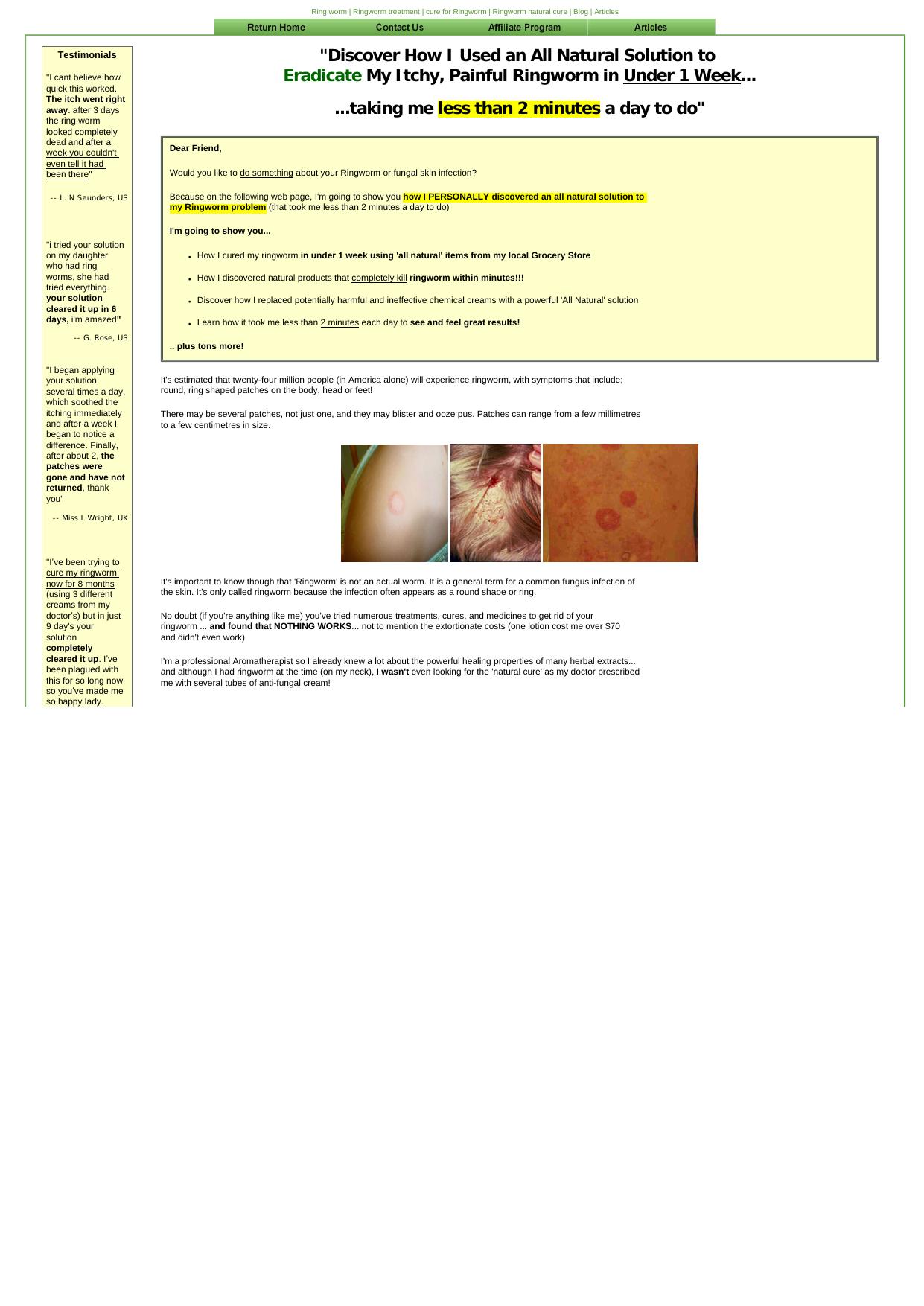 Treating Ringworm Fast. by Best of Kuszter's Collection