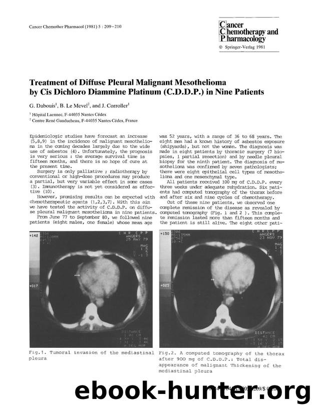 Treatment of diffuse pleural malignant mesothelioma by cis dichloro diammine platinum (C.D.D.P.) in nine patients by Unknown