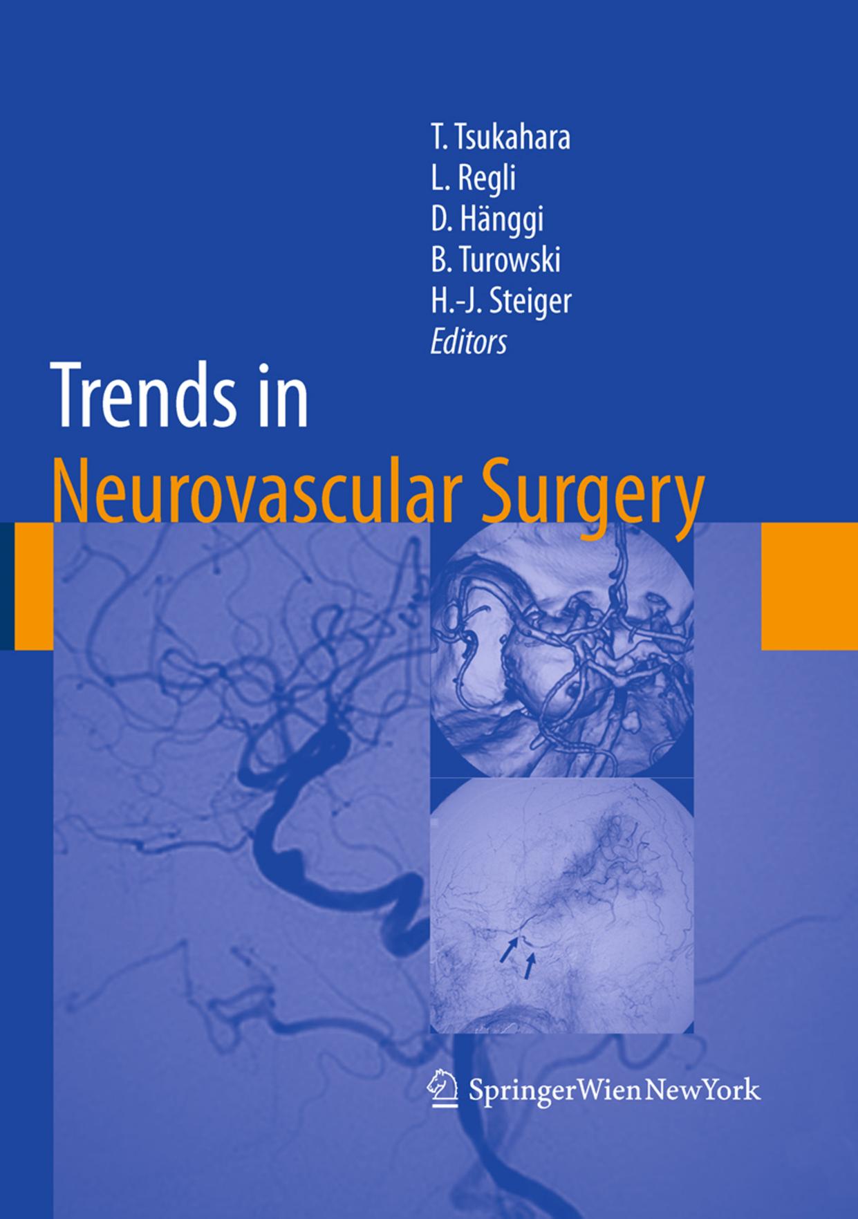 Trends in Neurovascular Surgery by unknow